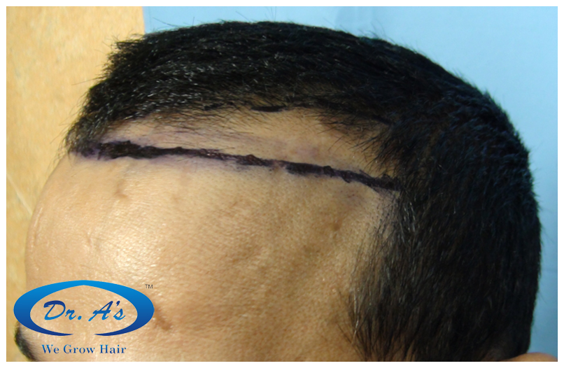 Before picture 311_55.jpg