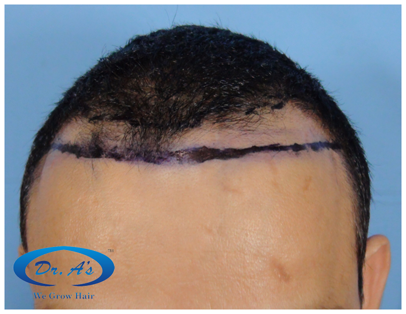 Before picture11_06.jpg