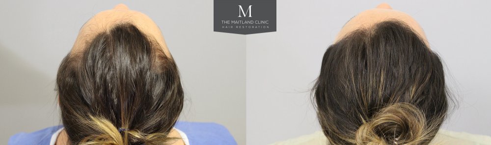 Before_After_back_Above.jpg