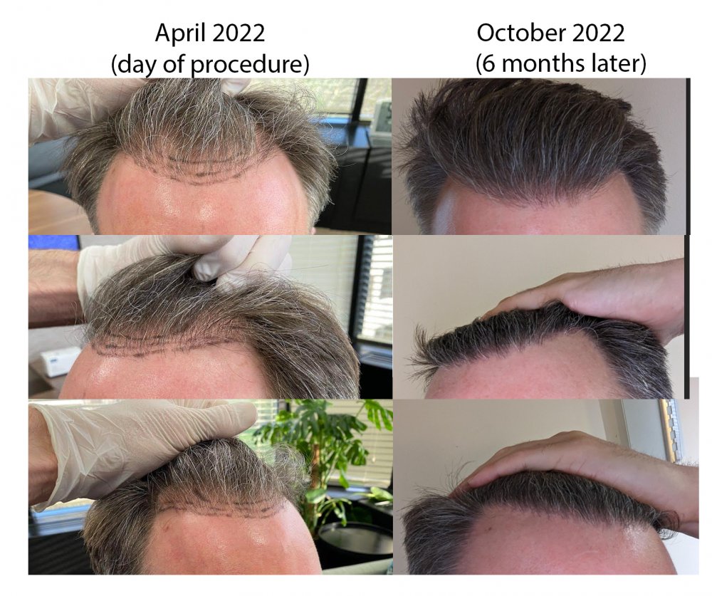 beforeafter.jpg