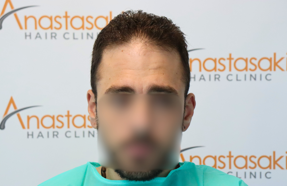 case #1 - before 1.png