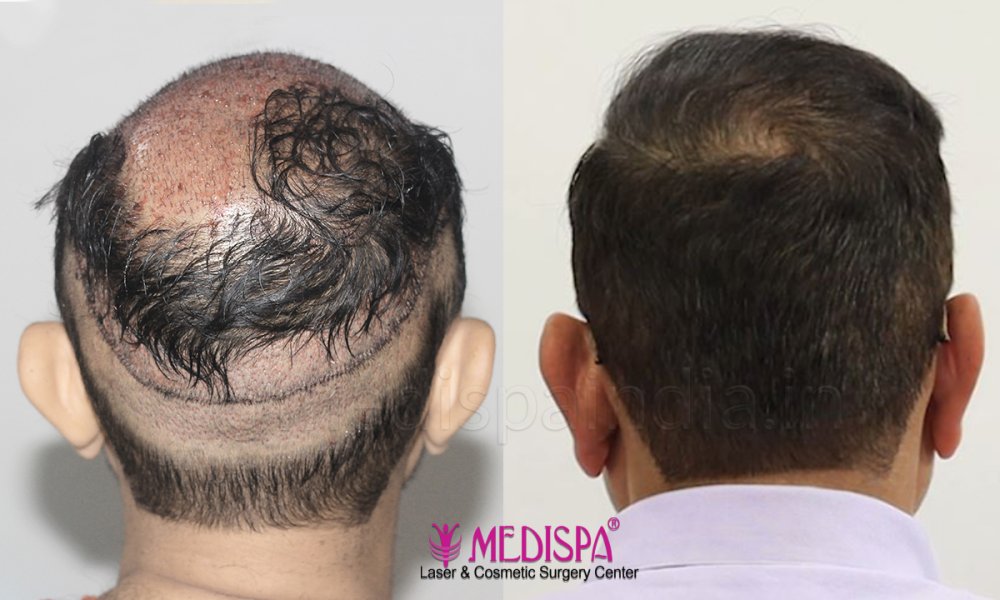 compare back.jpg