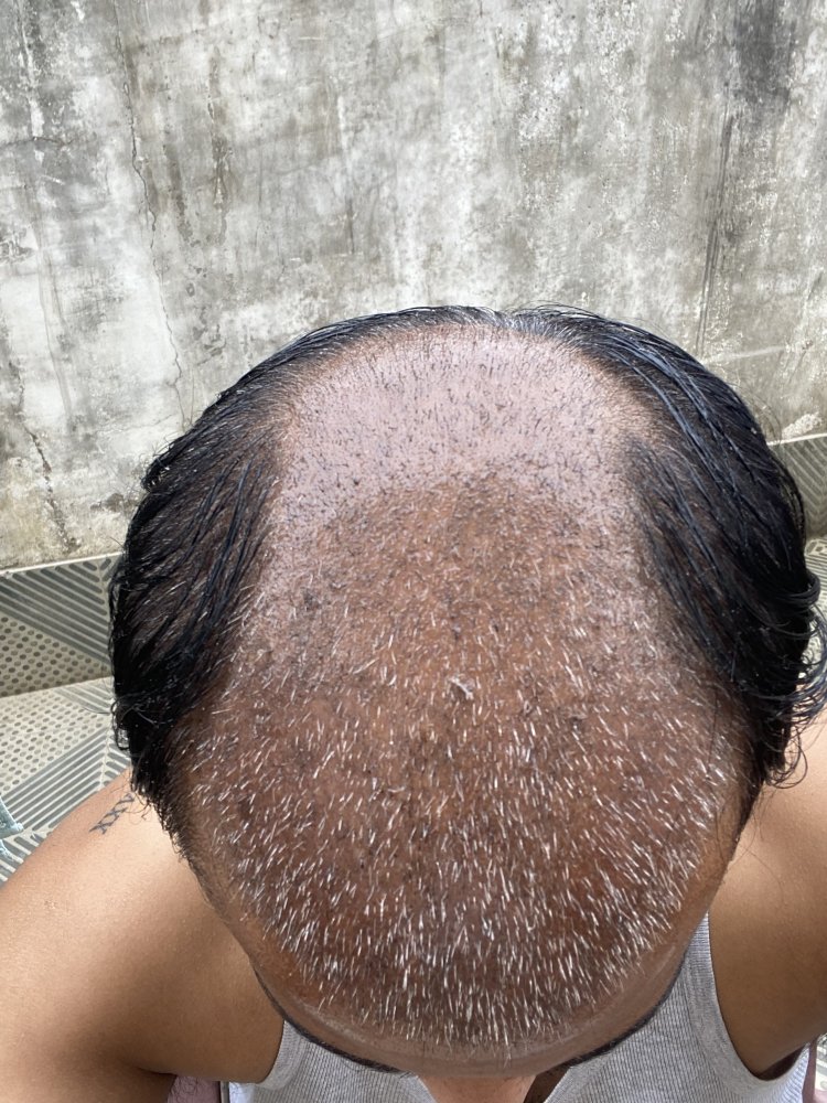 day 14.JPG