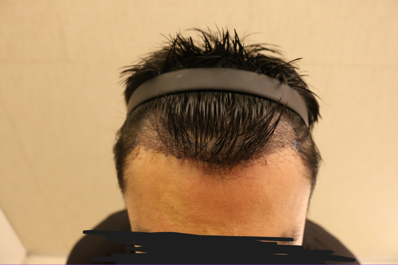 day1.png