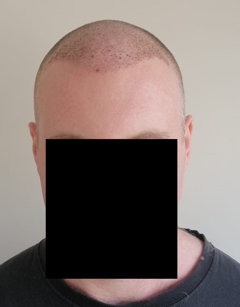 Day4Front.jpg