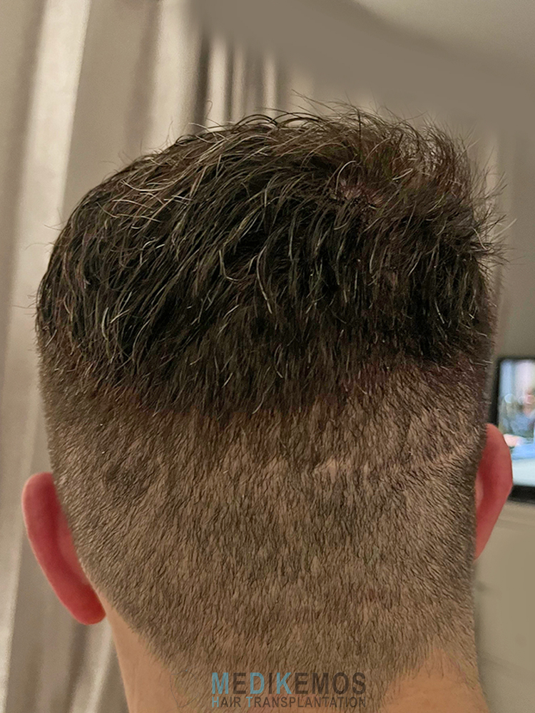 DP_12MONTHS_04.jpg