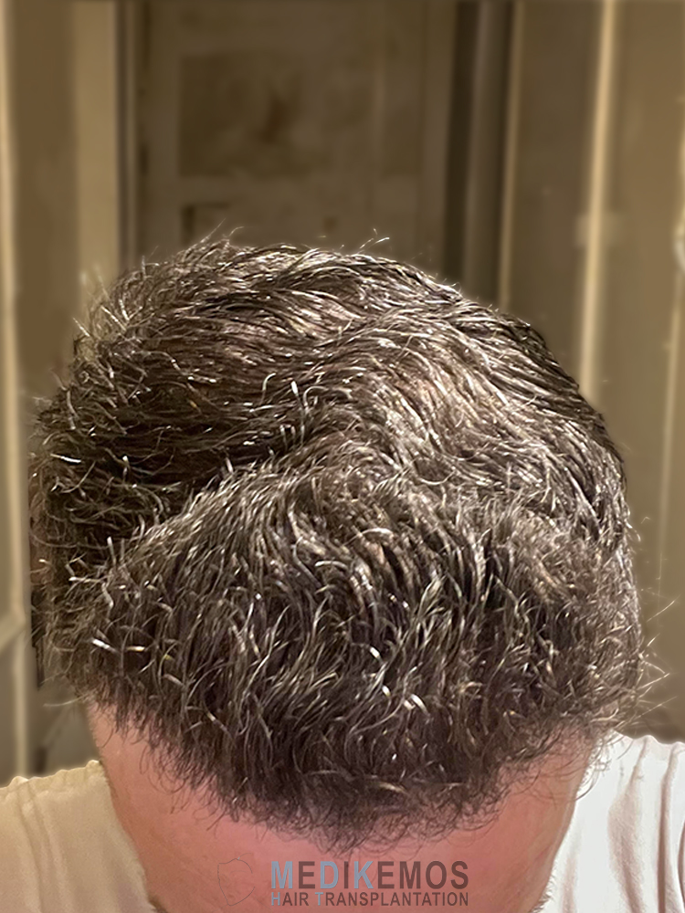 DP_12MONTHS_05.jpg