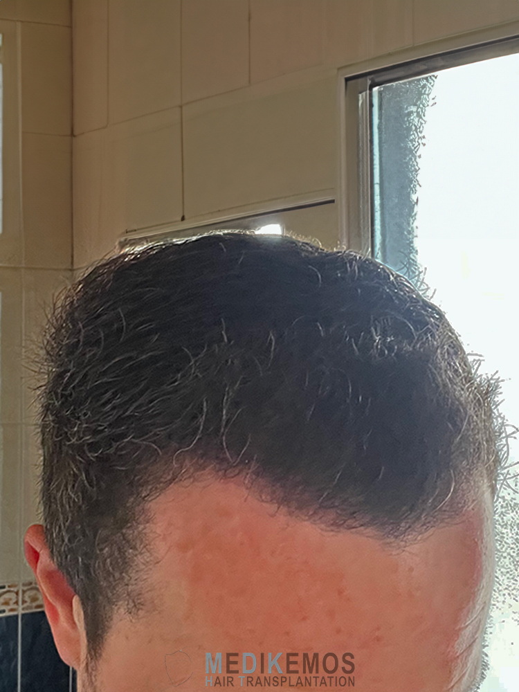 DP_3MONTHS_01.jpg