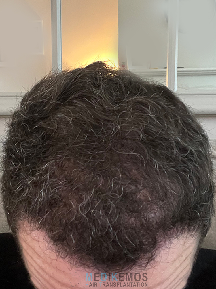 DP_3MONTHS_02.jpg