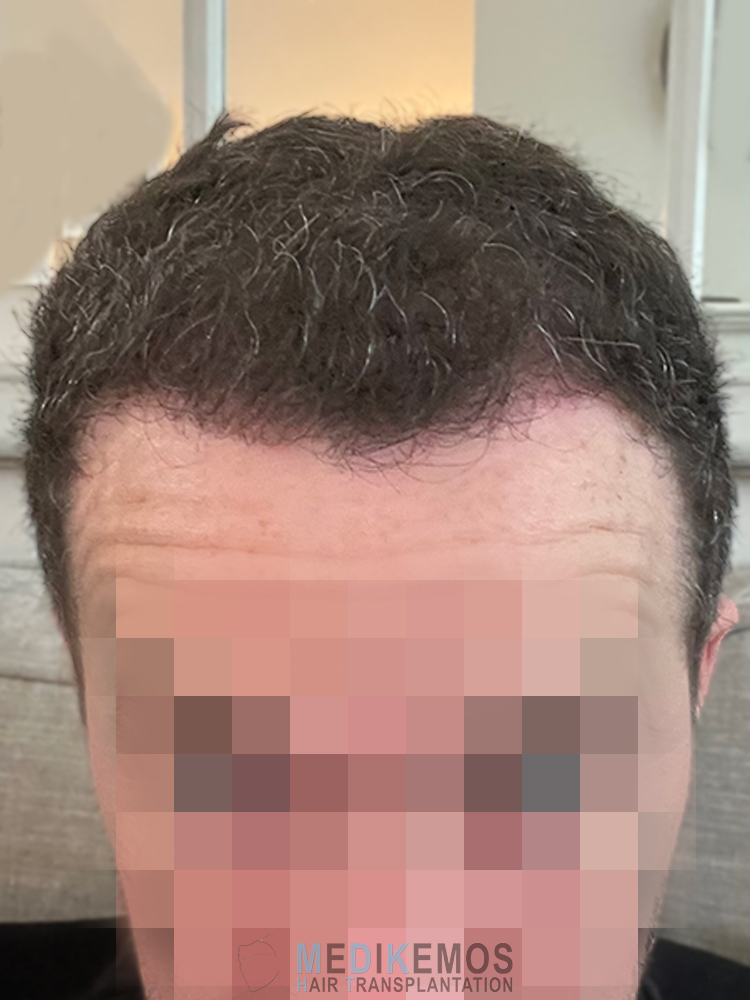 DP_3MONTHS_03.jpg