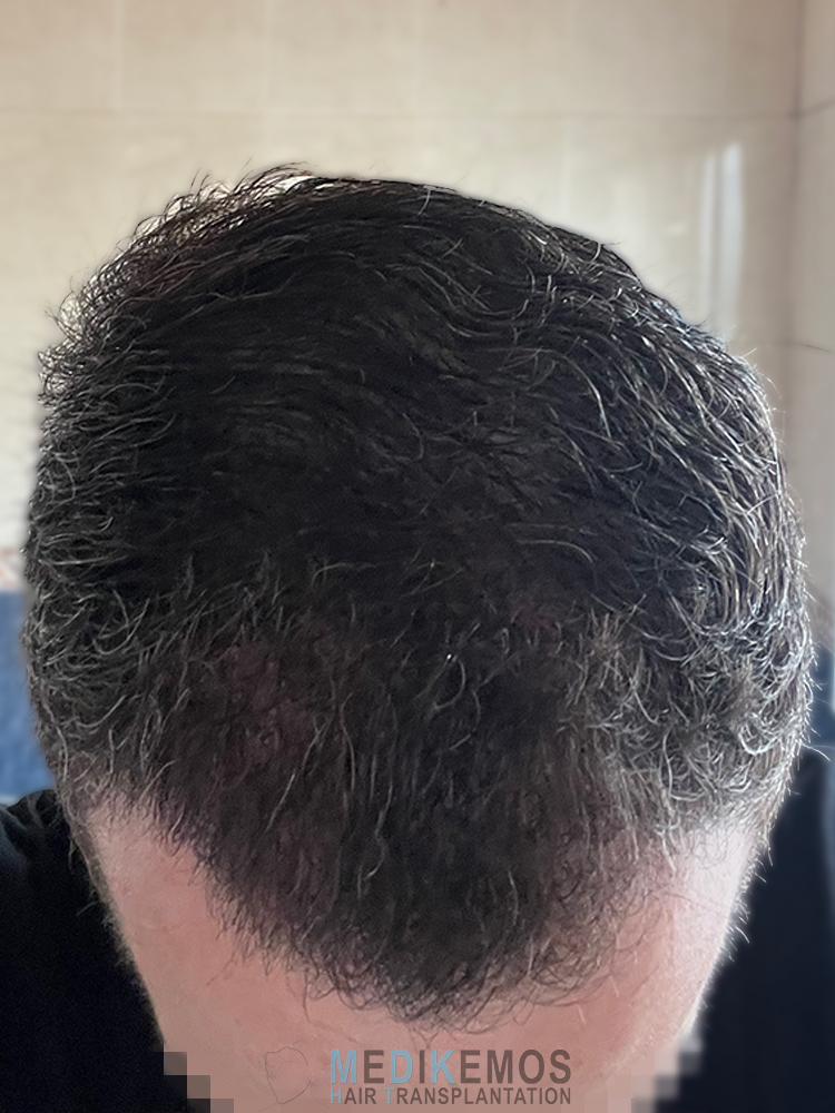 DP_3MONTHS_04.jpg
