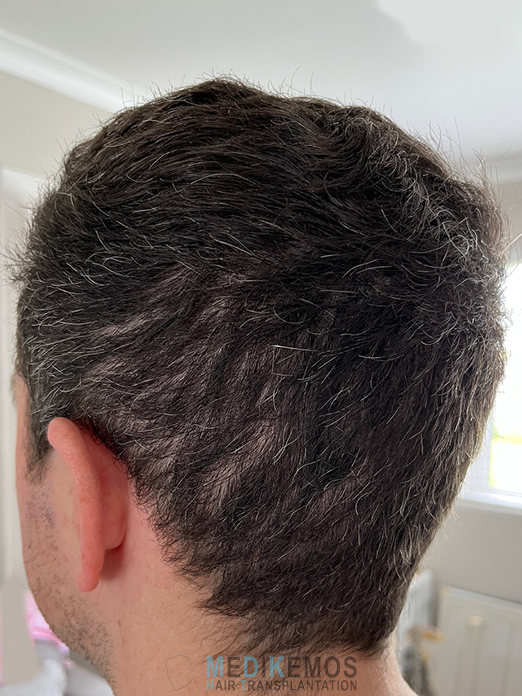 DP_3MONTHS_05.jpg