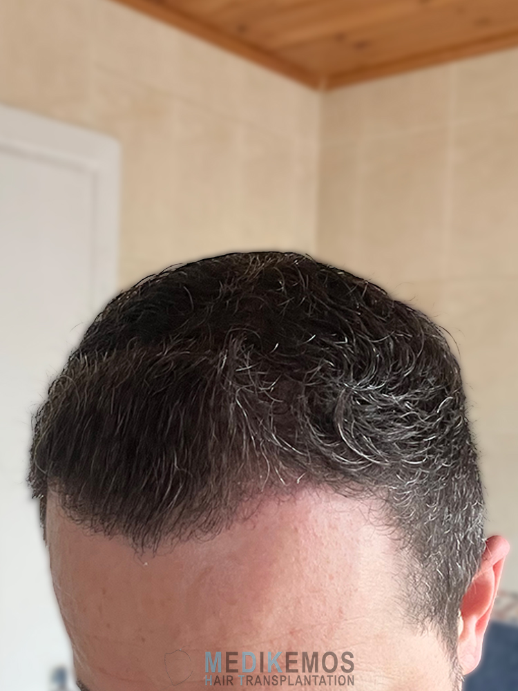 DP_3MONTHS_07.jpg
