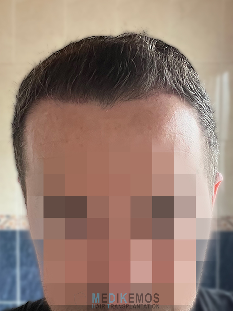 DP_3MONTHS_08.jpg