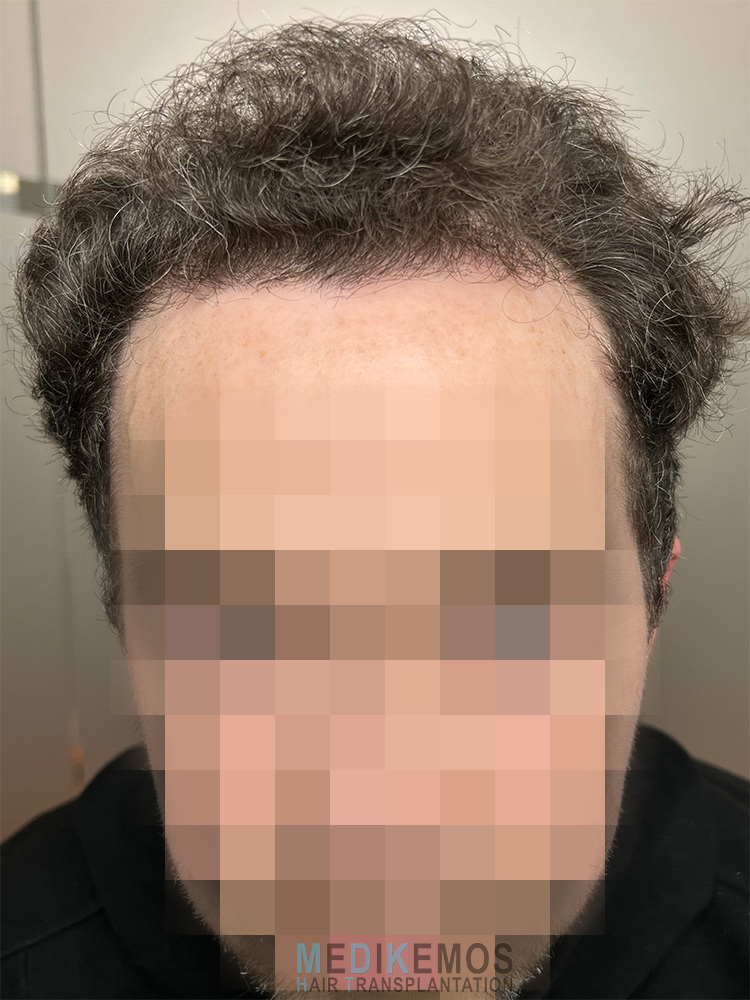 DP_Pre-Op_01.jpg