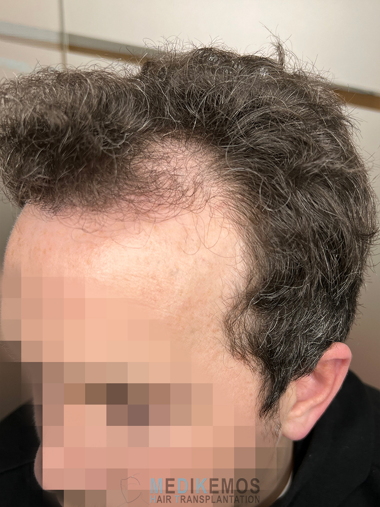 DP_Pre-Op_02.jpg