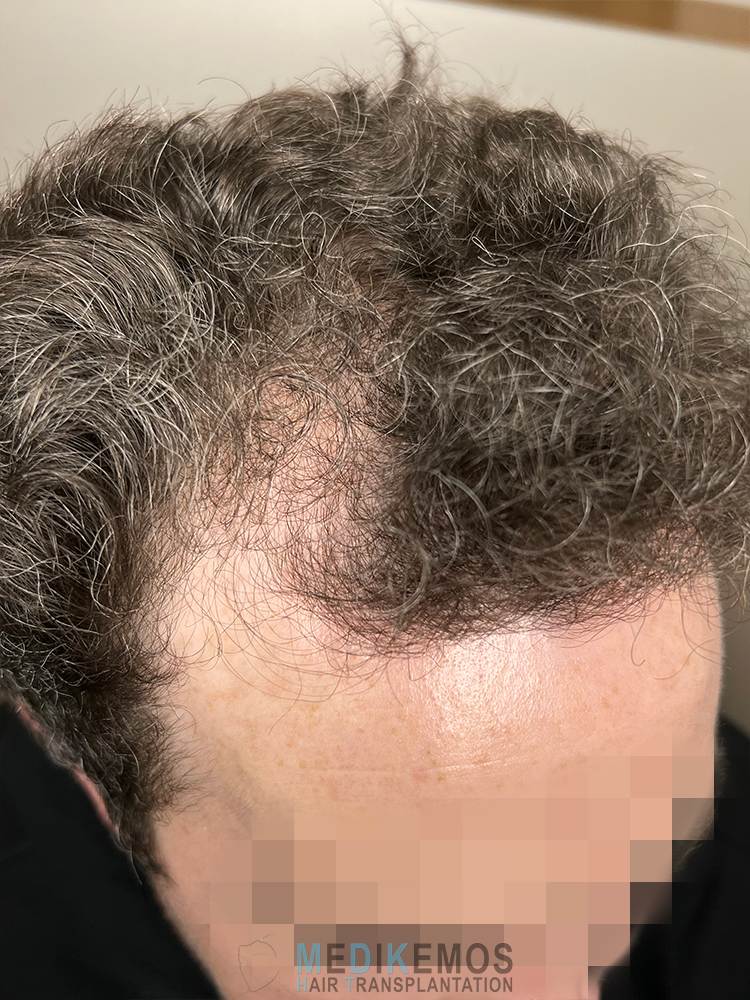 DP_Pre-Op_03.jpg