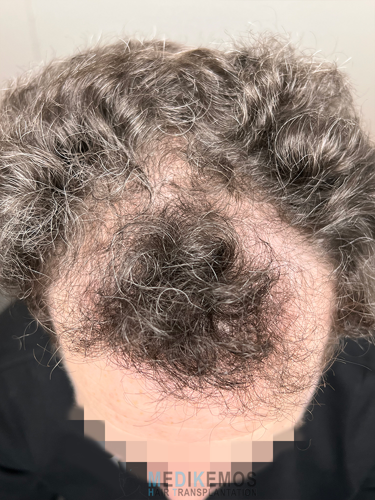 DP_Pre-Op_04.jpg