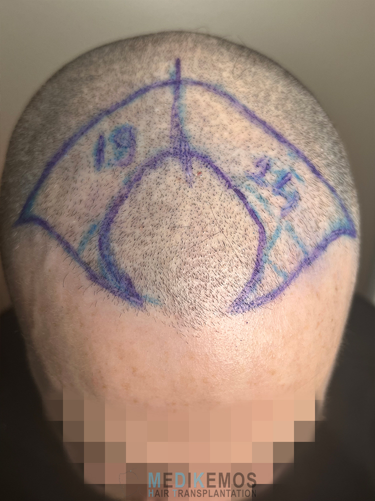 DP_Pre-OpM_06.jpg