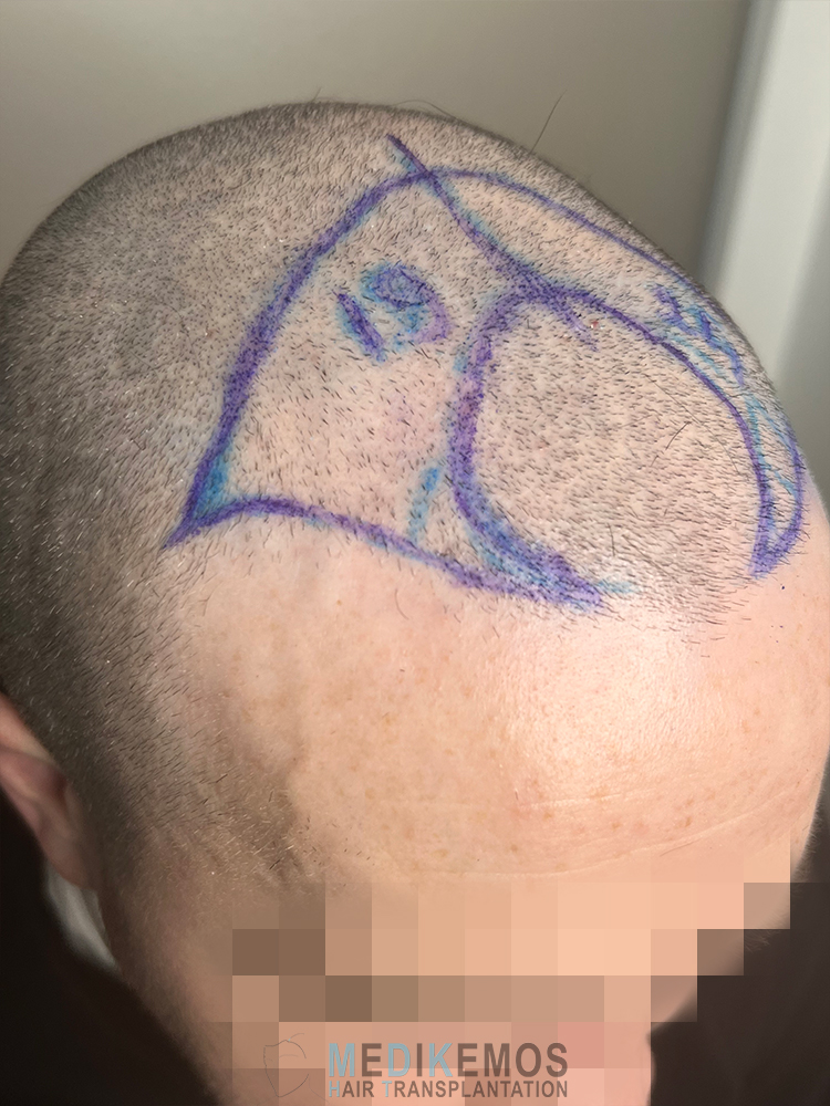 DP_Pre-OpM_08.jpg