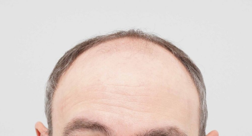 Dr. B Farjo hair transplant1.jpg