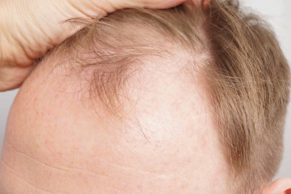 Dr. Bessam Farjo hair transplant4.jpg