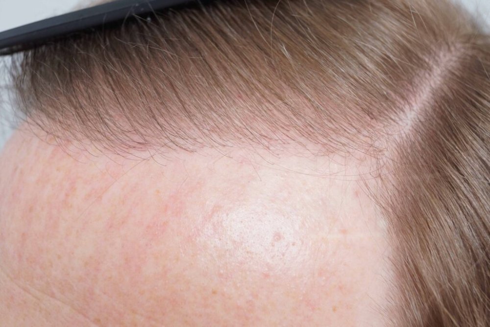 Dr. Bessam Farjo hair transplant8.jpg