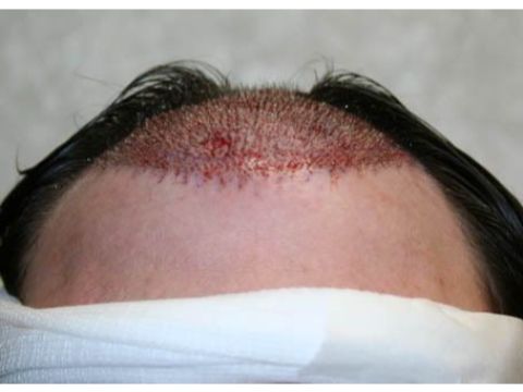 Dr Feller imm post op 1.jpg