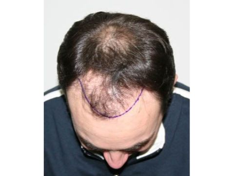 Dr Feller pre op 1.jpg