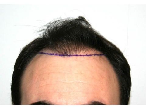 Dr Feller pre op 2.jpg