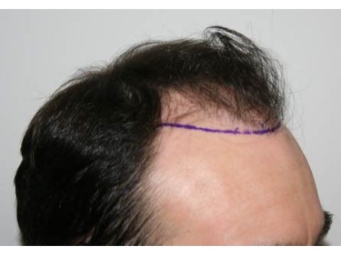 Dr Feller pre op 3.jpg