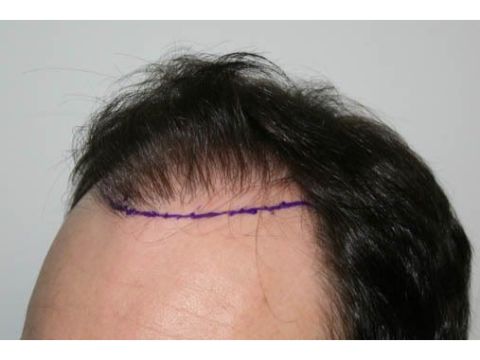 Dr Feller pre op 4.jpg