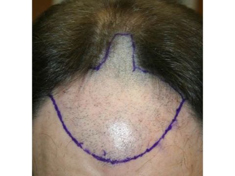 Dr Feller pre op 5.jpg