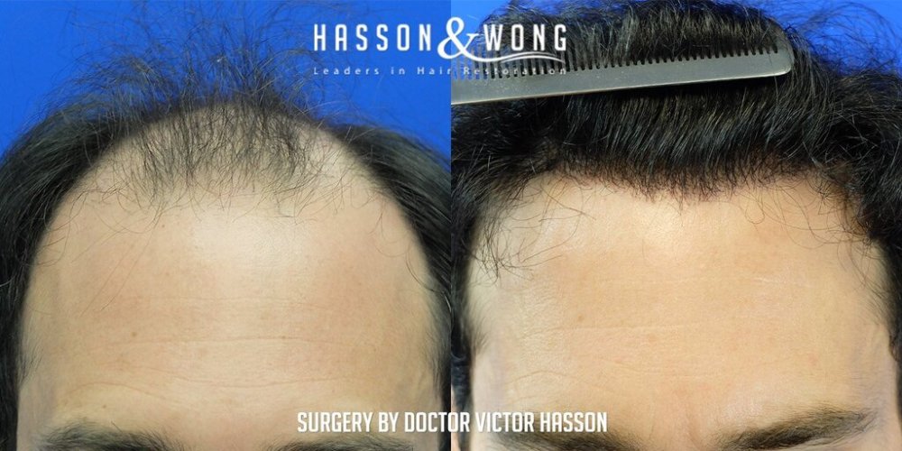 Dr Hasson10.jpg