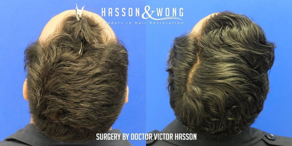 Dr Hasson10.jpg