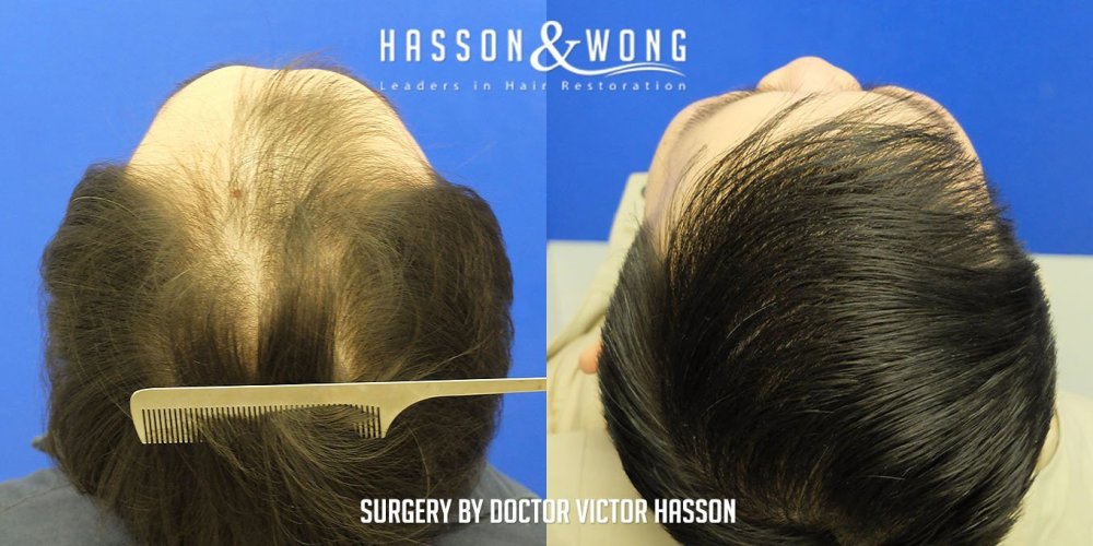Dr. Hasson11.jpg