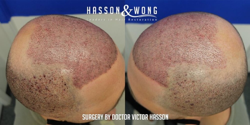 Dr Hasson11.jpg