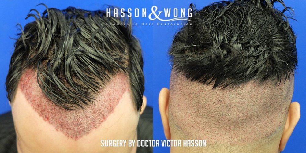 Dr Hasson11.jpg