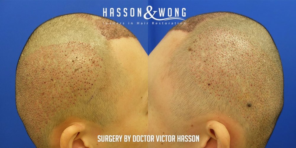 Dr. Hasson12.jpg