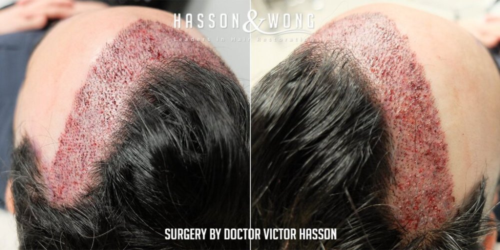 Dr Hasson12.jpg