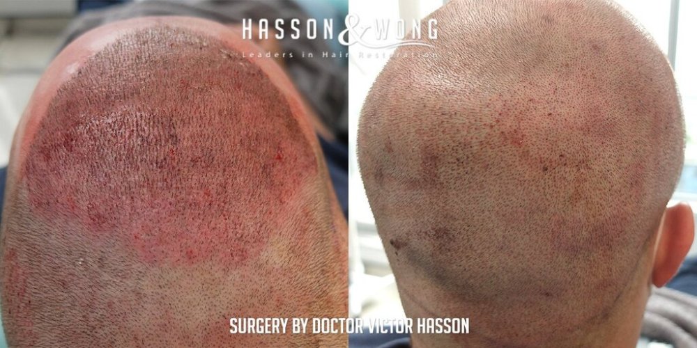 Dr. Hasson14.jpg