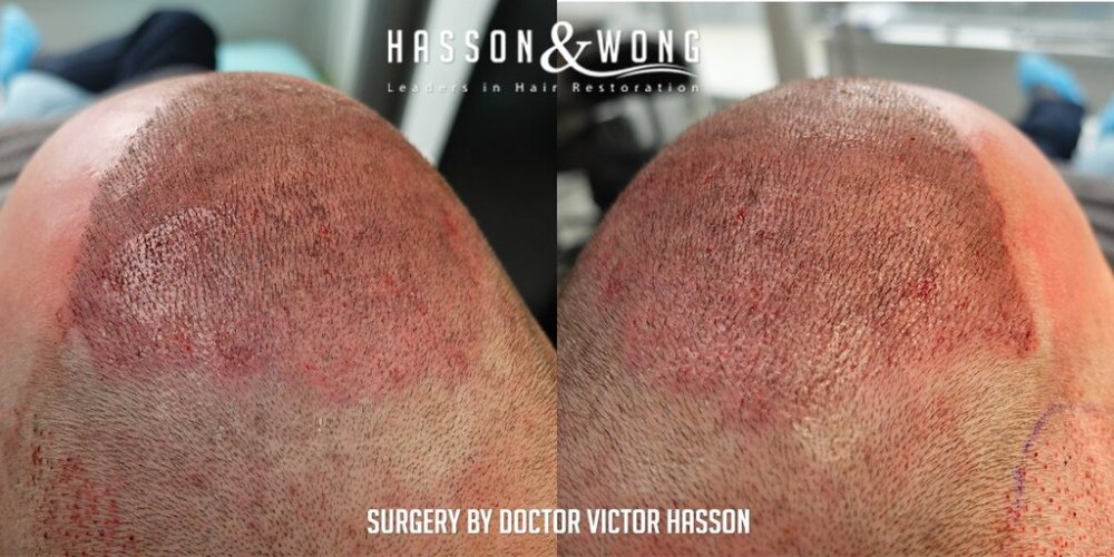 Dr. Hasson15.jpg