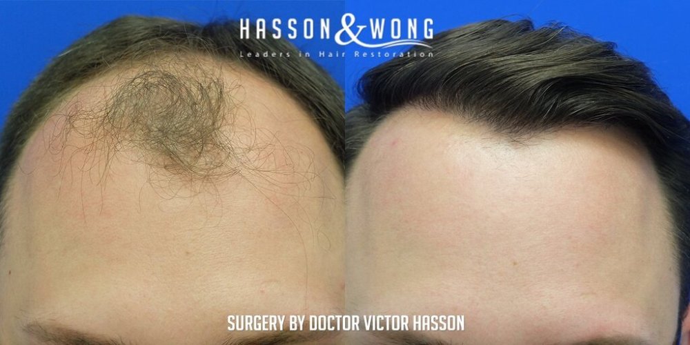 Dr. Hasson2.jpg