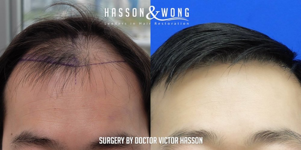 Dr. Hasson3.jpg