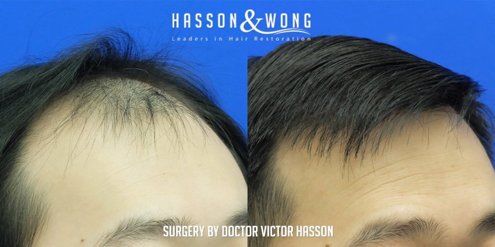 Dr. Hasson8.jpg