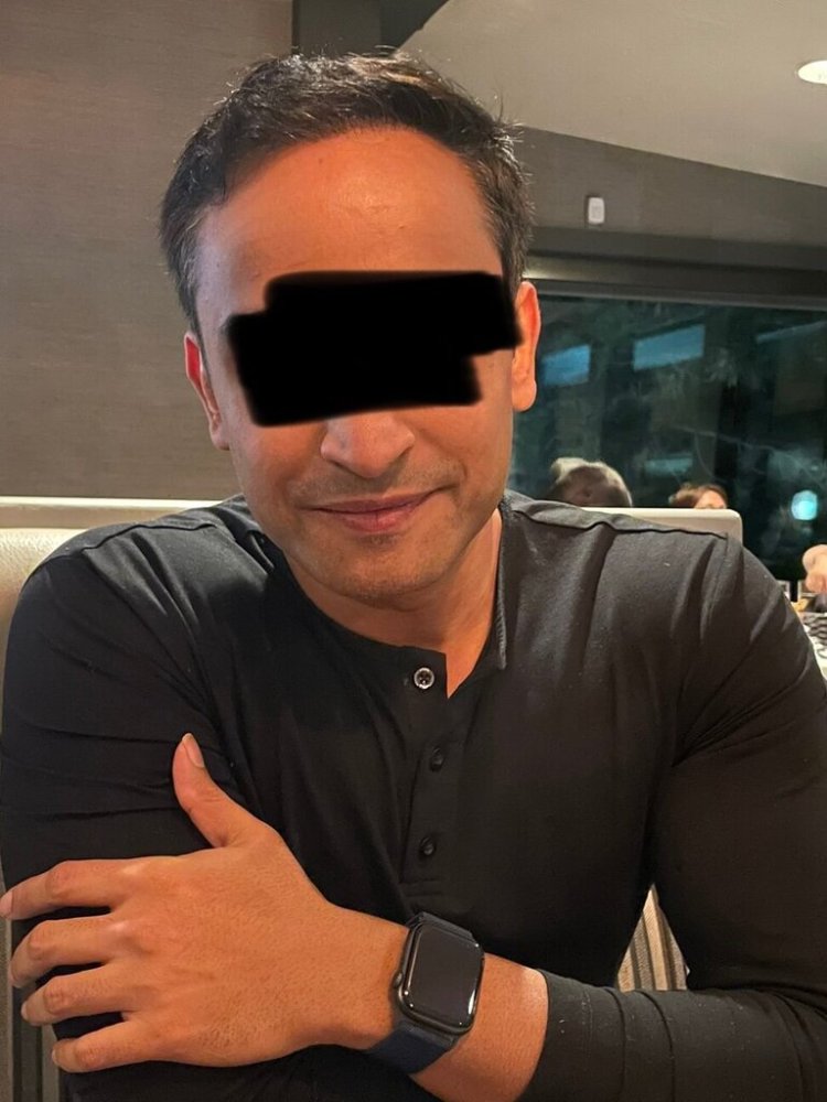 Dr. Ron Shapiro 8.5 months post-op hair transplant3.jpeg