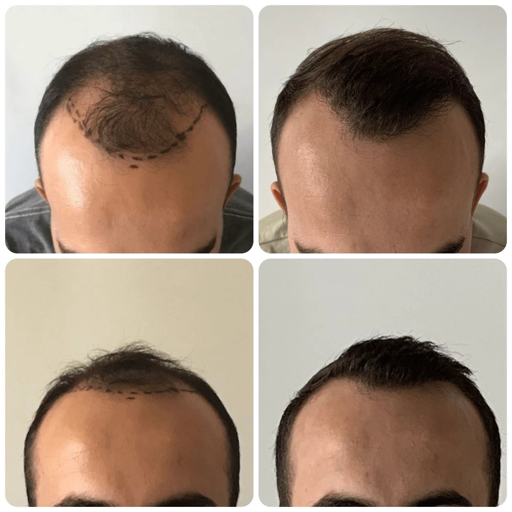 drbonaros-glasgow-hair-transplant-clinic.jpg