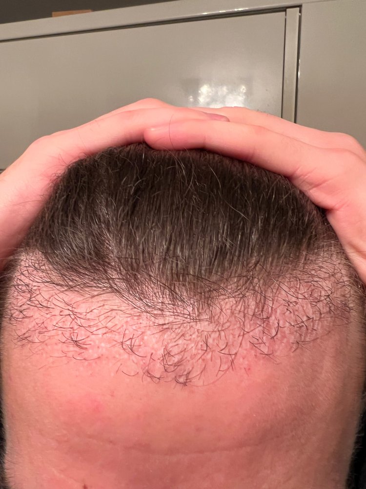 Facetune_24-11-2022-19-37-04.jpg