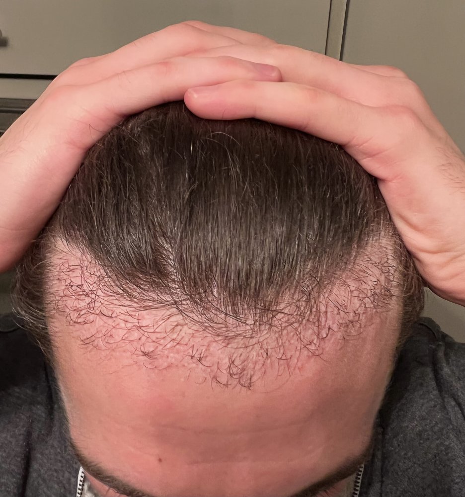 Facetune_24-11-2022-19-38-48.jpg