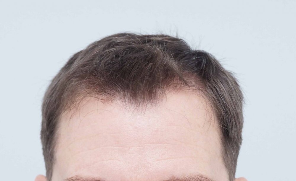 Farjo Hair Institute 1.jpg